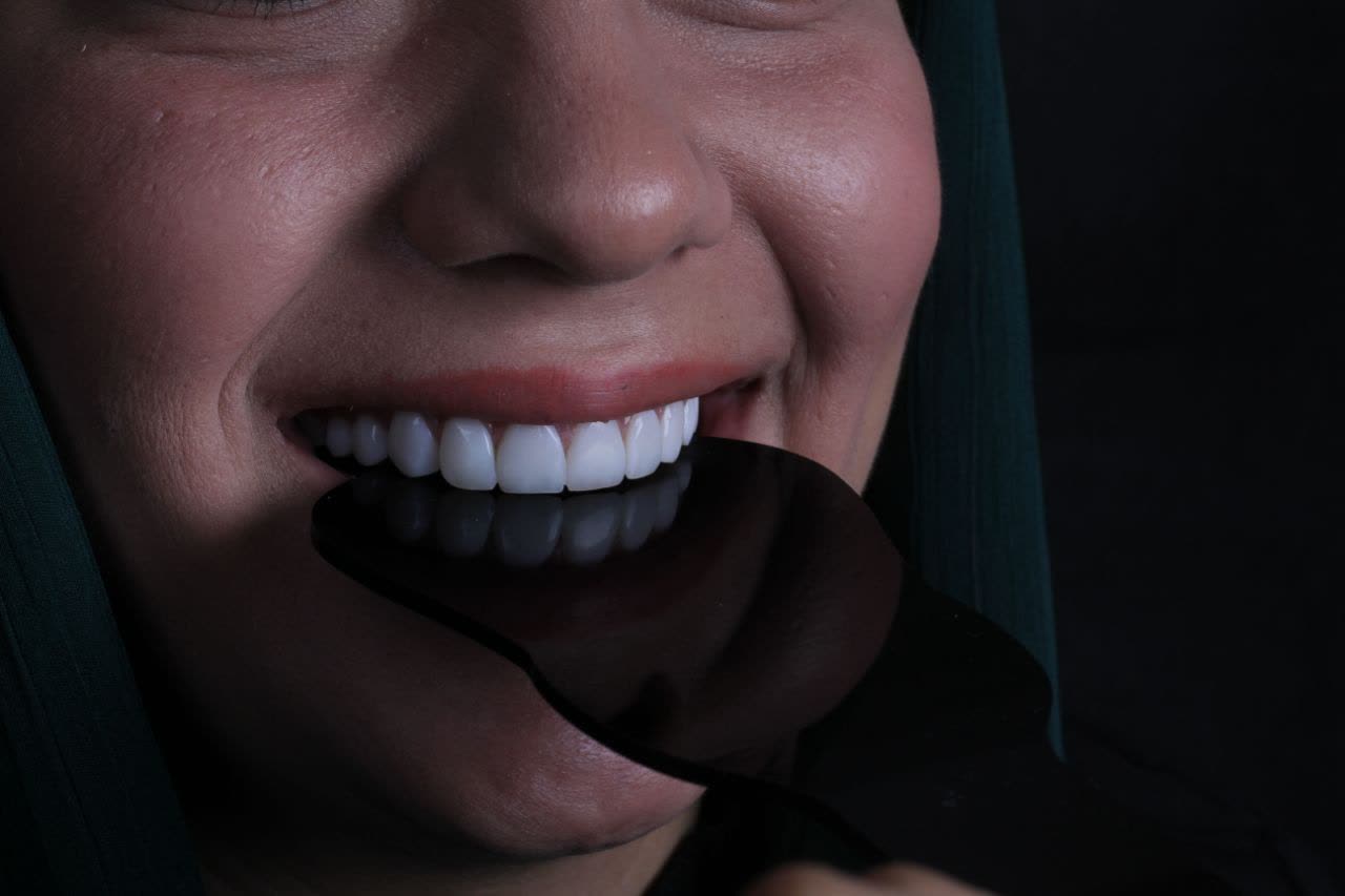 بلیچینگ